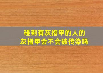 碰到有灰指甲的人的灰指甲会不会被传染吗