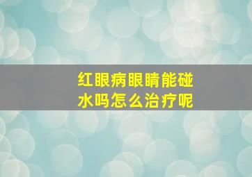 红眼病眼睛能碰水吗怎么治疗呢