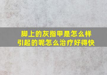 脚上的灰指甲是怎么样引起的呢怎么治疗好得快