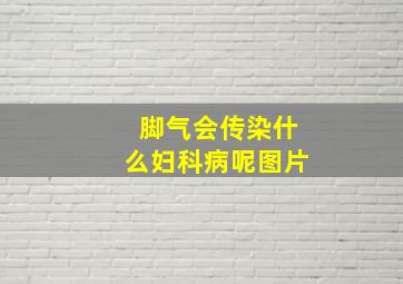 脚气会传染什么妇科病呢图片