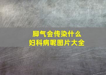 脚气会传染什么妇科病呢图片大全