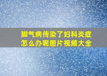 脚气病传染了妇科炎症怎么办呢图片视频大全