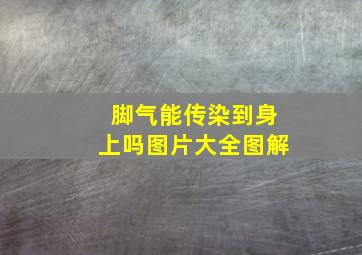 脚气能传染到身上吗图片大全图解