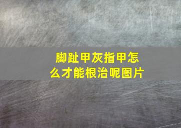 脚趾甲灰指甲怎么才能根治呢图片