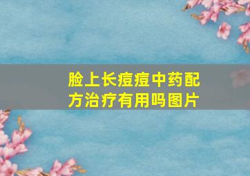 脸上长痘痘中药配方治疗有用吗图片