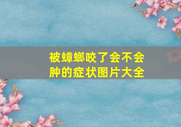 被蟑螂咬了会不会肿的症状图片大全