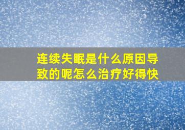 连续失眠是什么原因导致的呢怎么治疗好得快