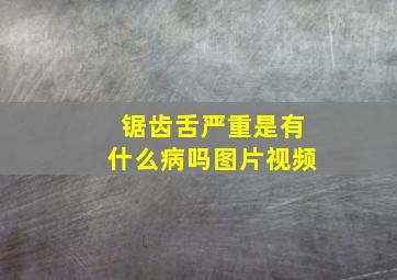 锯齿舌严重是有什么病吗图片视频