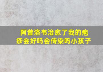 阿昔洛韦治愈了我的疱疹会好吗会传染吗小孩子