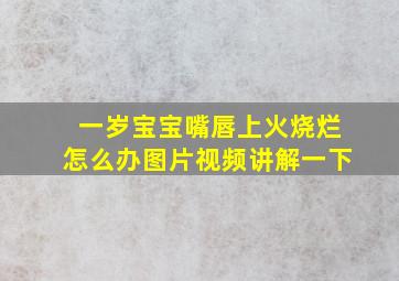 一岁宝宝嘴唇上火烧烂怎么办图片视频讲解一下