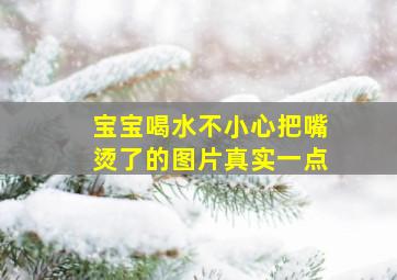 宝宝喝水不小心把嘴烫了的图片真实一点