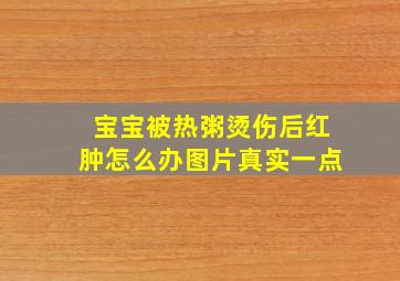 宝宝被热粥烫伤后红肿怎么办图片真实一点