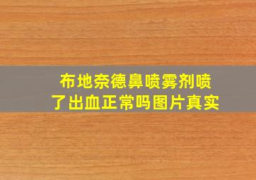 布地奈德鼻喷雾剂喷了出血正常吗图片真实