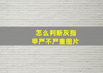 怎么判断灰指甲严不严重图片