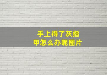 手上得了灰指甲怎么办呢图片