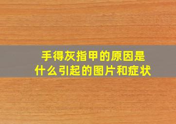 手得灰指甲的原因是什么引起的图片和症状