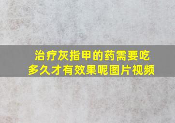 治疗灰指甲的药需要吃多久才有效果呢图片视频