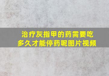 治疗灰指甲的药需要吃多久才能停药呢图片视频