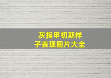 灰指甲初期样子表现图片大全