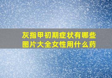 灰指甲初期症状有哪些图片大全女性用什么药