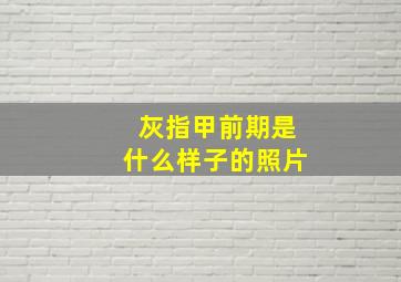 灰指甲前期是什么样子的照片