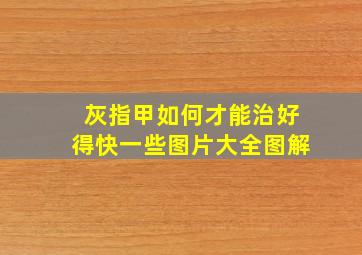 灰指甲如何才能治好得快一些图片大全图解