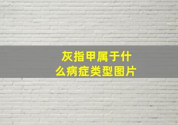 灰指甲属于什么病症类型图片