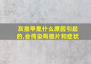 灰指甲是什么原因引起的,会传染吗图片和症状