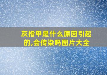 灰指甲是什么原因引起的,会传染吗图片大全