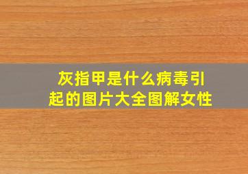 灰指甲是什么病毒引起的图片大全图解女性