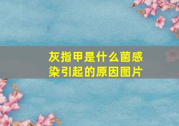 灰指甲是什么菌感染引起的原因图片