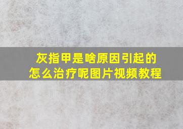 灰指甲是啥原因引起的怎么治疗呢图片视频教程