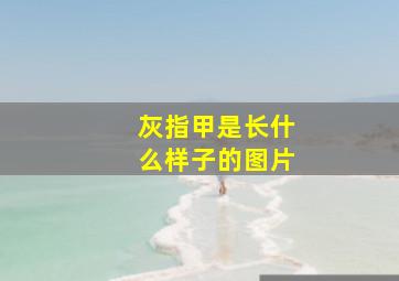 灰指甲是长什么样子的图片