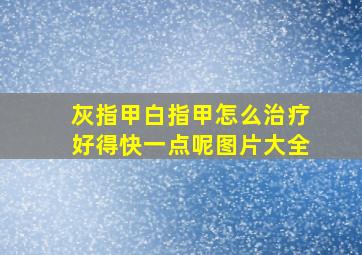 灰指甲白指甲怎么治疗好得快一点呢图片大全