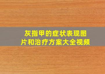 灰指甲的症状表现图片和治疗方案大全视频