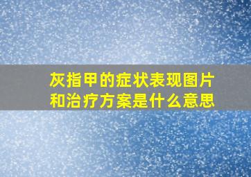 灰指甲的症状表现图片和治疗方案是什么意思