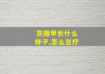 灰指甲长什么样子,怎么治疗