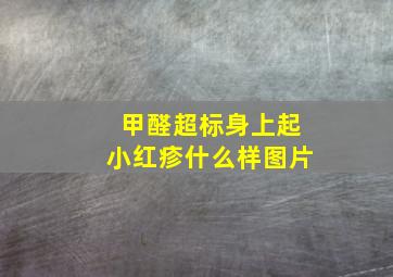 甲醛超标身上起小红疹什么样图片