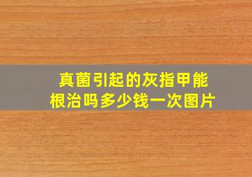 真菌引起的灰指甲能根治吗多少钱一次图片