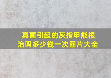 真菌引起的灰指甲能根治吗多少钱一次图片大全