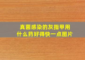 真菌感染的灰指甲用什么药好得快一点图片