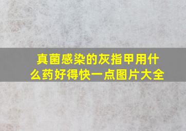 真菌感染的灰指甲用什么药好得快一点图片大全