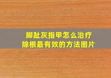 脚趾灰指甲怎么治疗除根最有效的方法图片