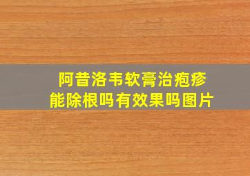 阿昔洛韦软膏治疱疹能除根吗有效果吗图片